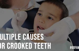 Multiple Causes For Crooked Teeth