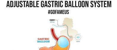 Lose Weight With The Only Adjustable Gastric Balloon System
